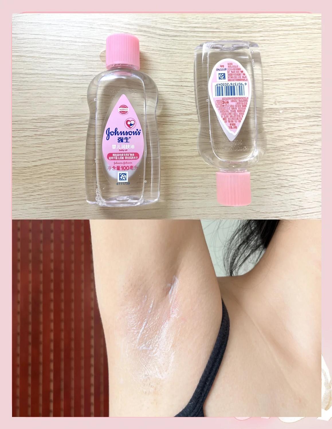 怎么去除腋下黑色素沉淀