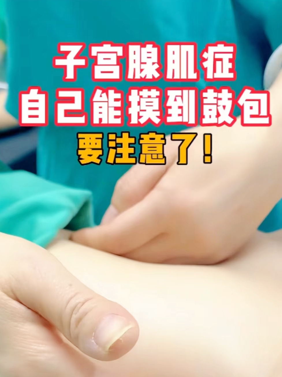 子宫腺肌症的症状表现是什么