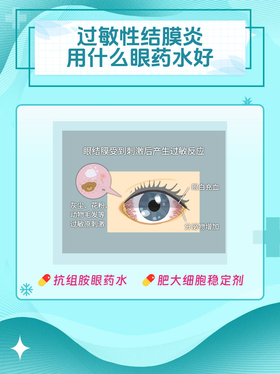 结膜炎该怎么办