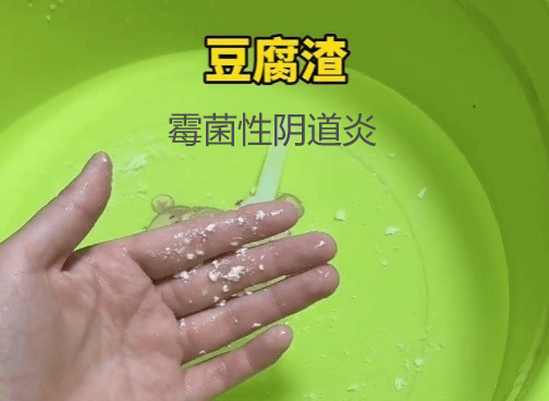 霉菌性阴道炎反复复发怎么办