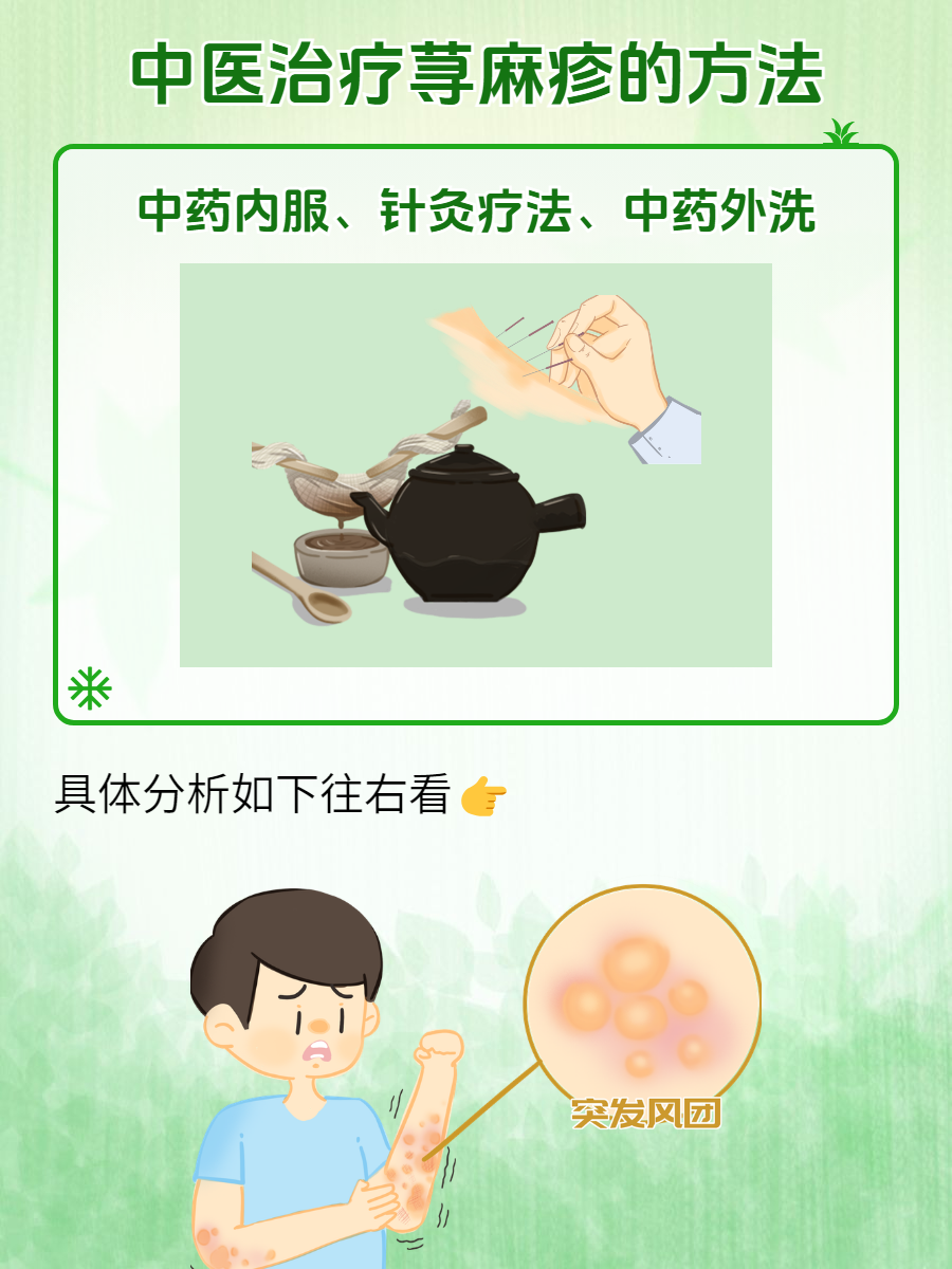 急性荨麻疹怎么治疗?