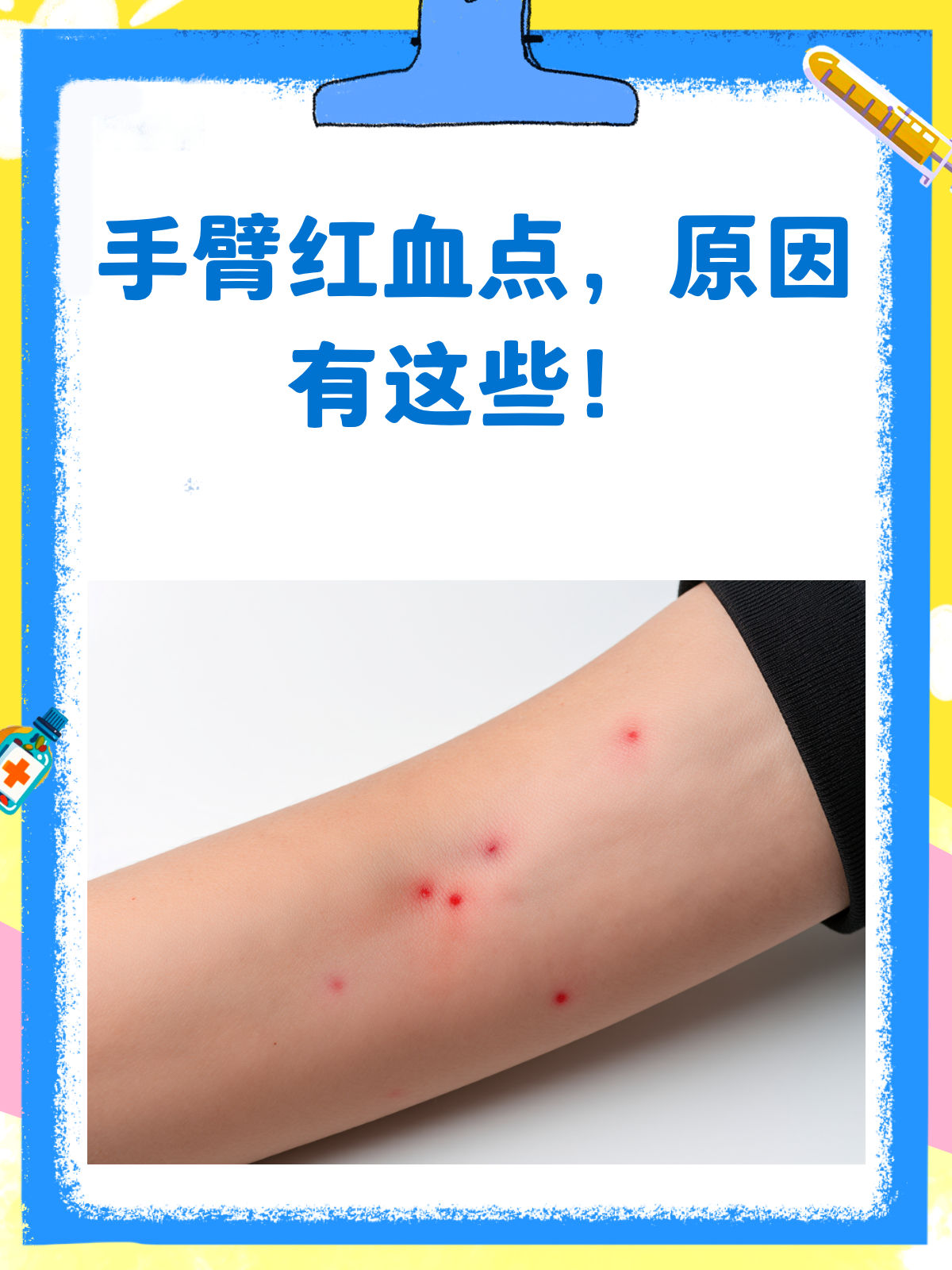 身上长了小红血点,怎么回事?