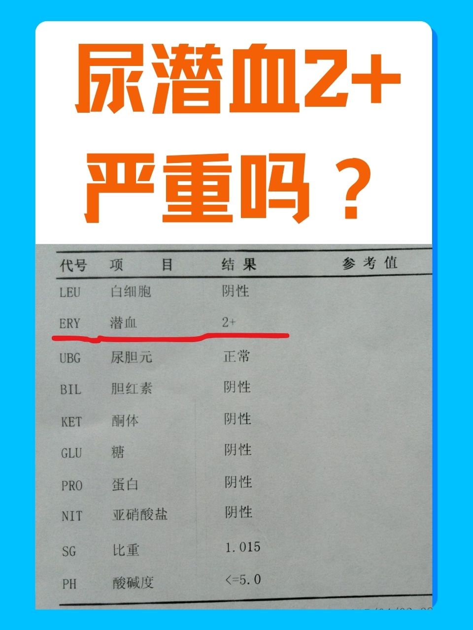肾功能检查是查尿,查血吗?