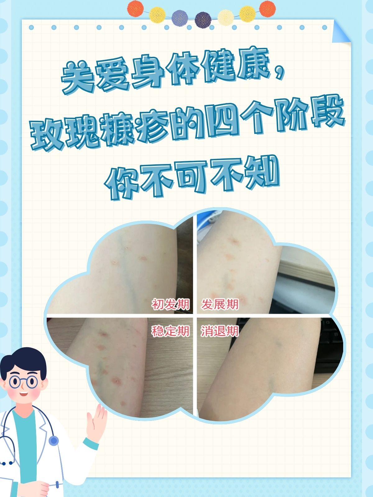 玫瑰糠疹会复发吗