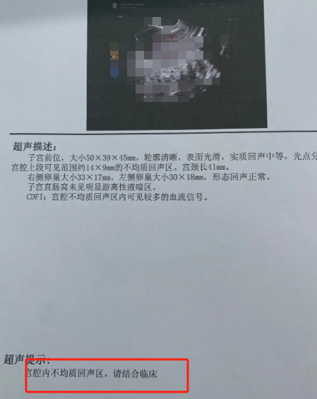 刚刚怀孕可以吃药打掉吗?