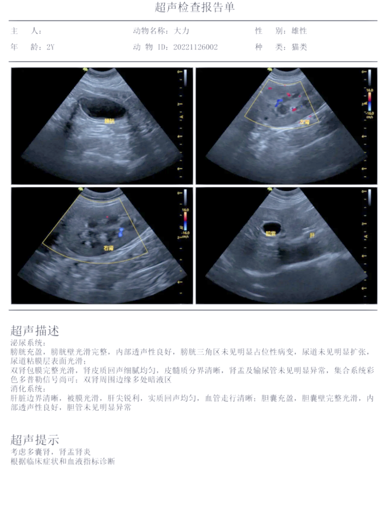 多囊肾最新治疗方法有哪些?
