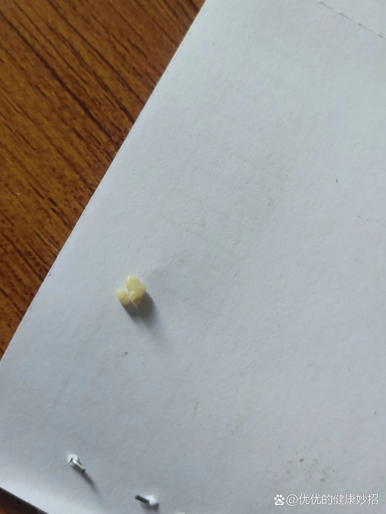 喉咙里白色的是什么东西