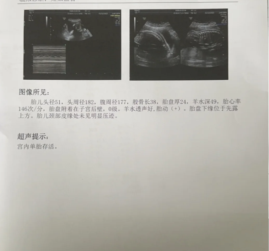 怀孕五个月胎动减少怎么回事