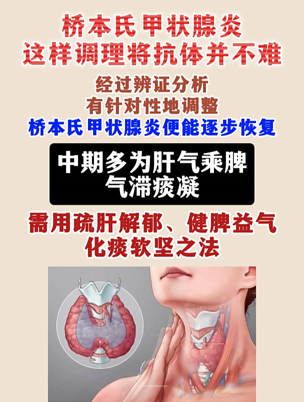 桥本甲状腺炎我康复了?