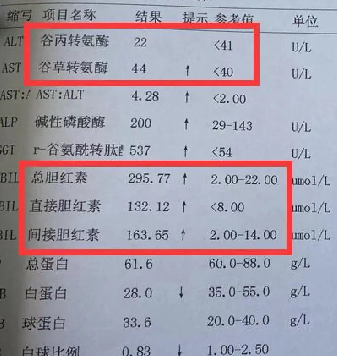 谷丙转氨酶偏高怎么办?