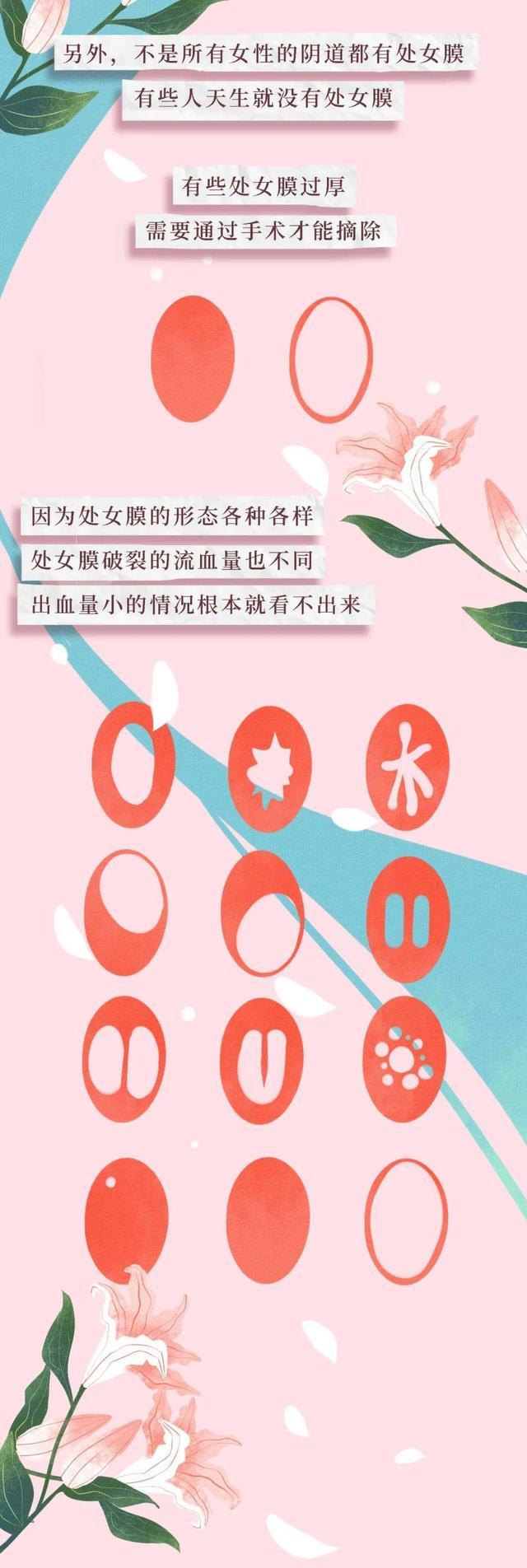 50岁以上的女人阴道水增多是怎么回事