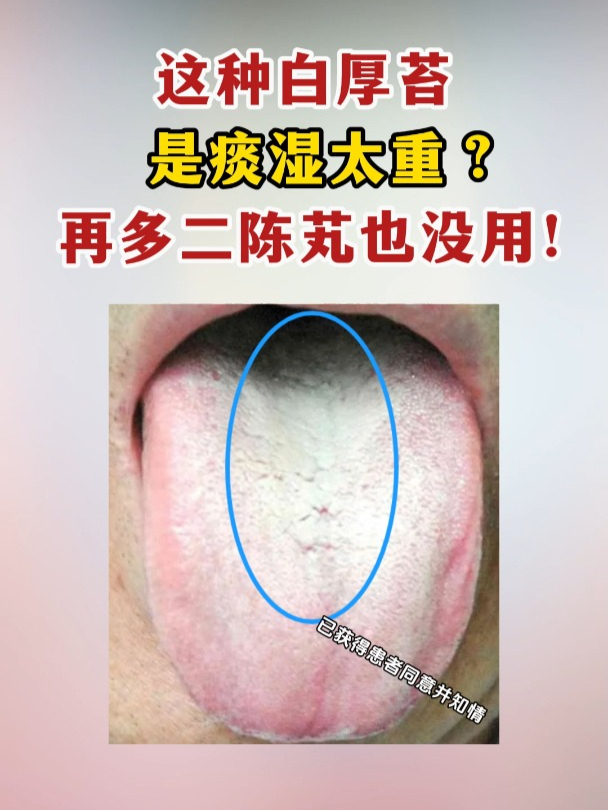 舌苔厚白,口臭