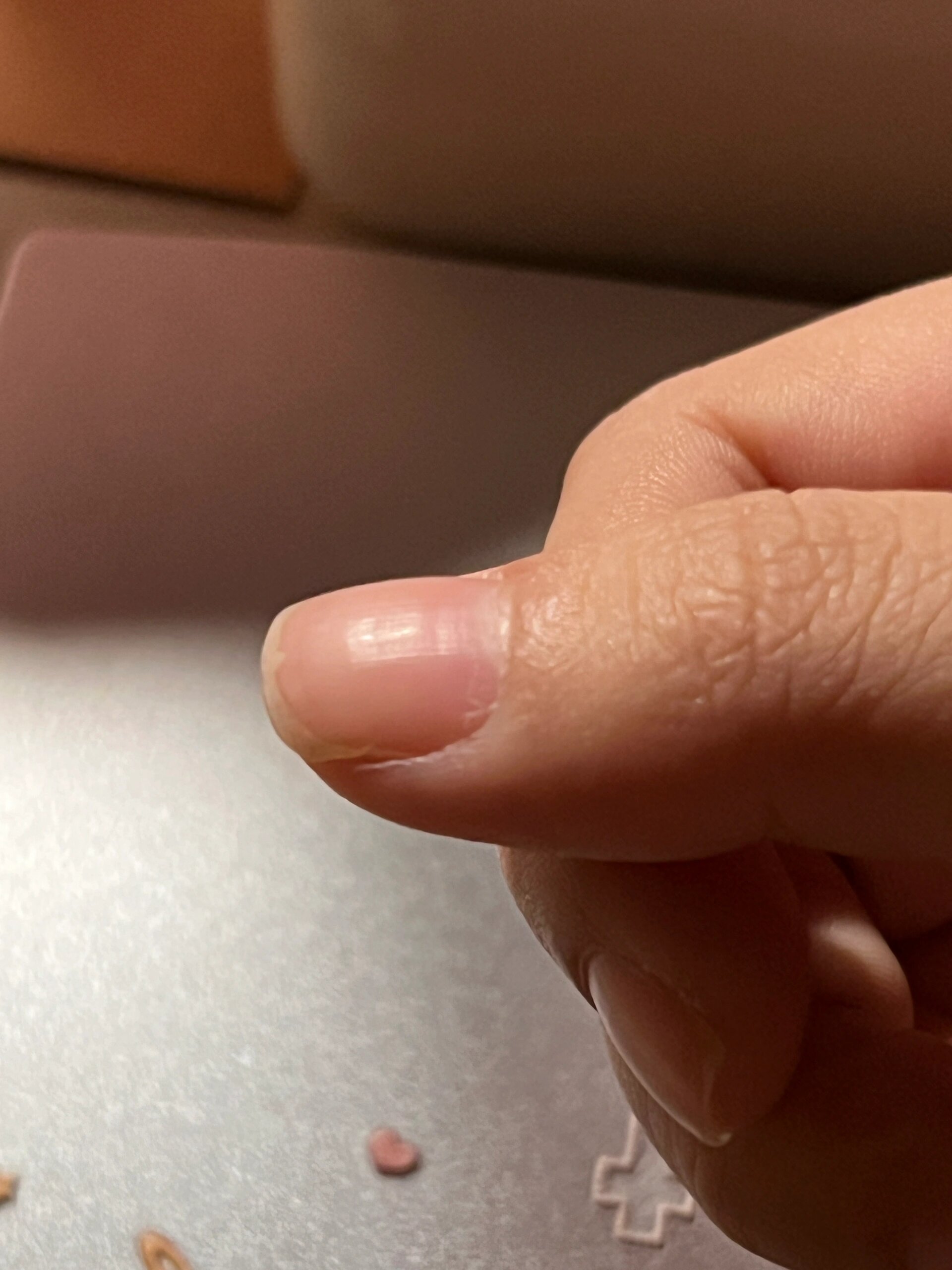 大拇指指甲凹凸不平怎么办