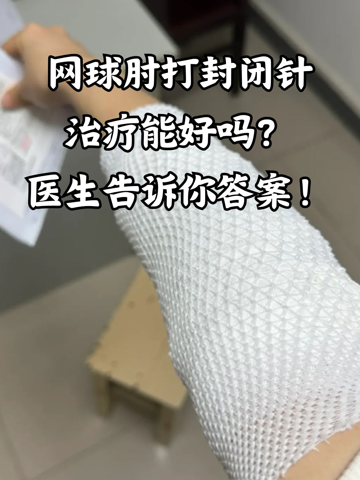 网球肘怎么治疗好得快