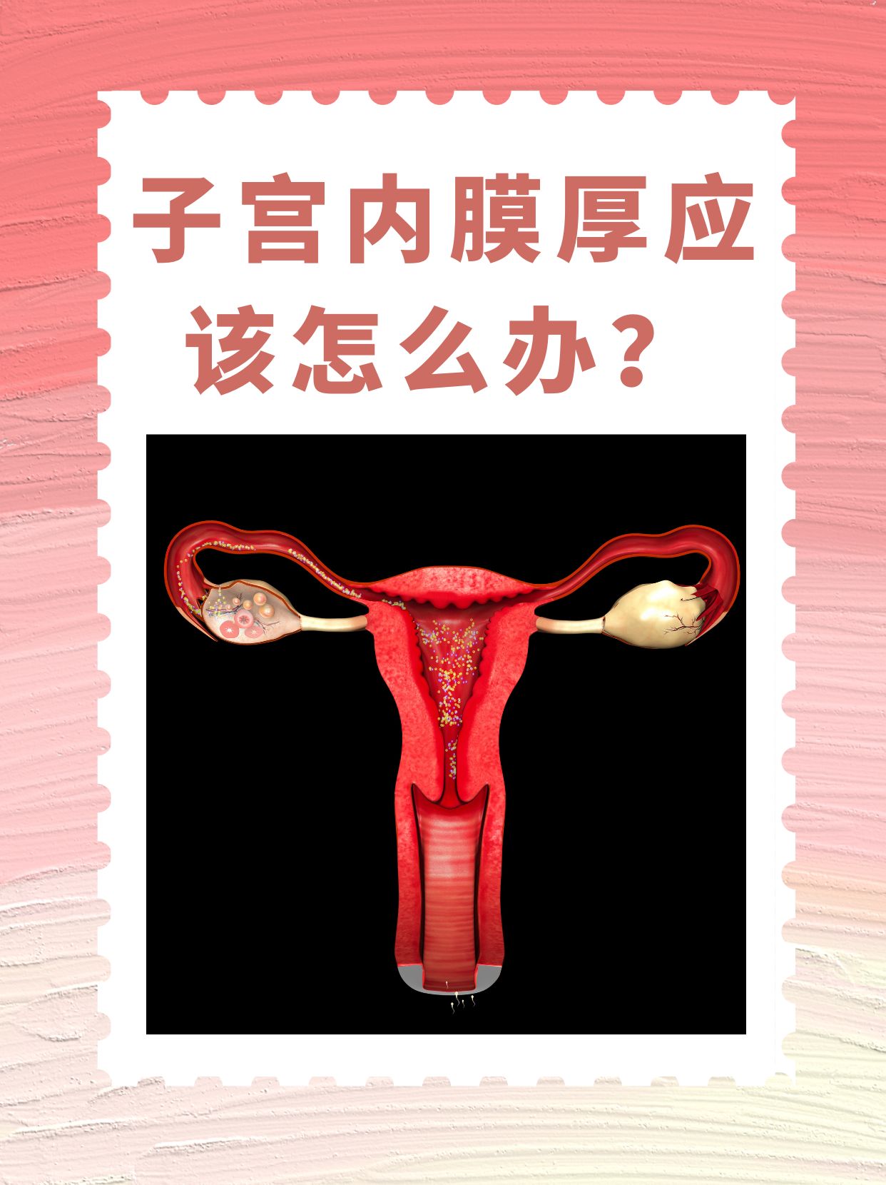 子宫内膜厚度多少能正常怀孕