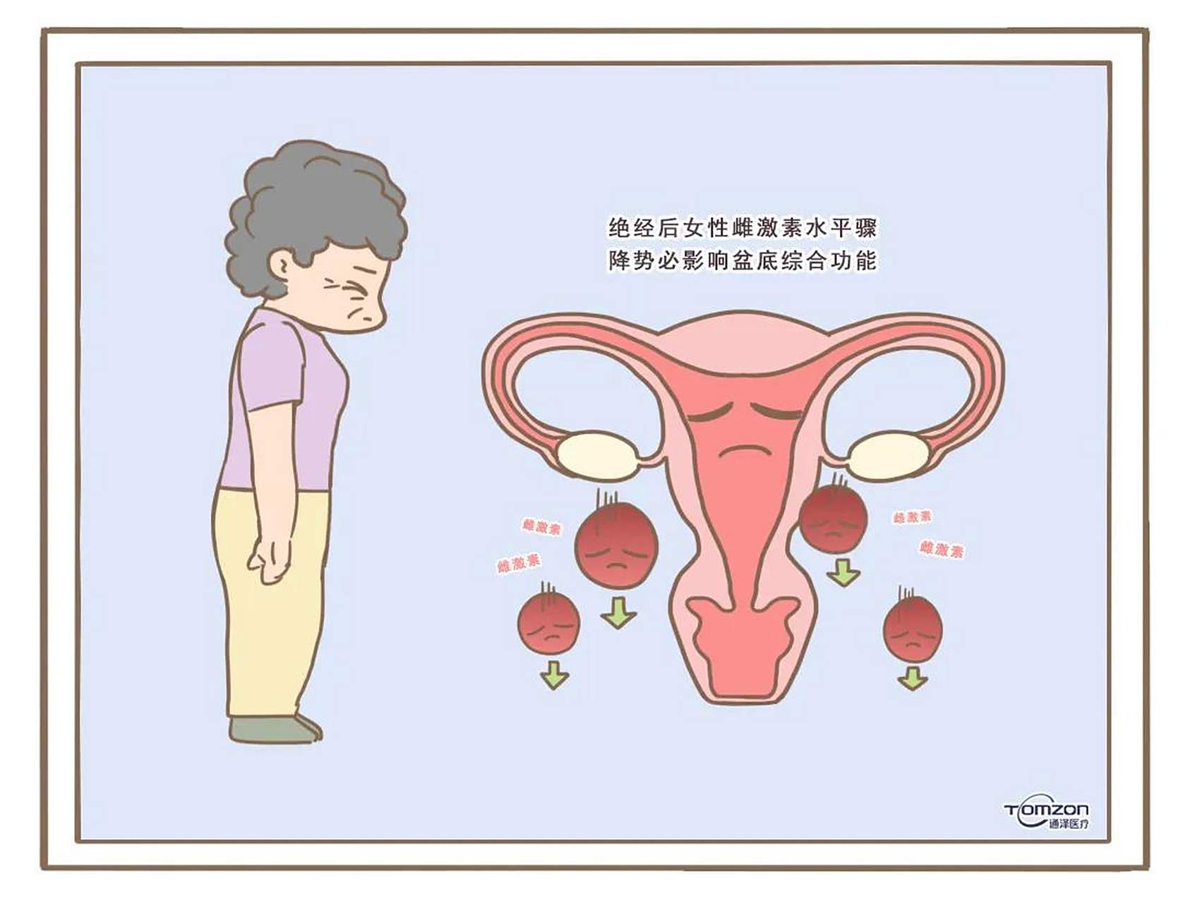 什么是妇女更年期综合征