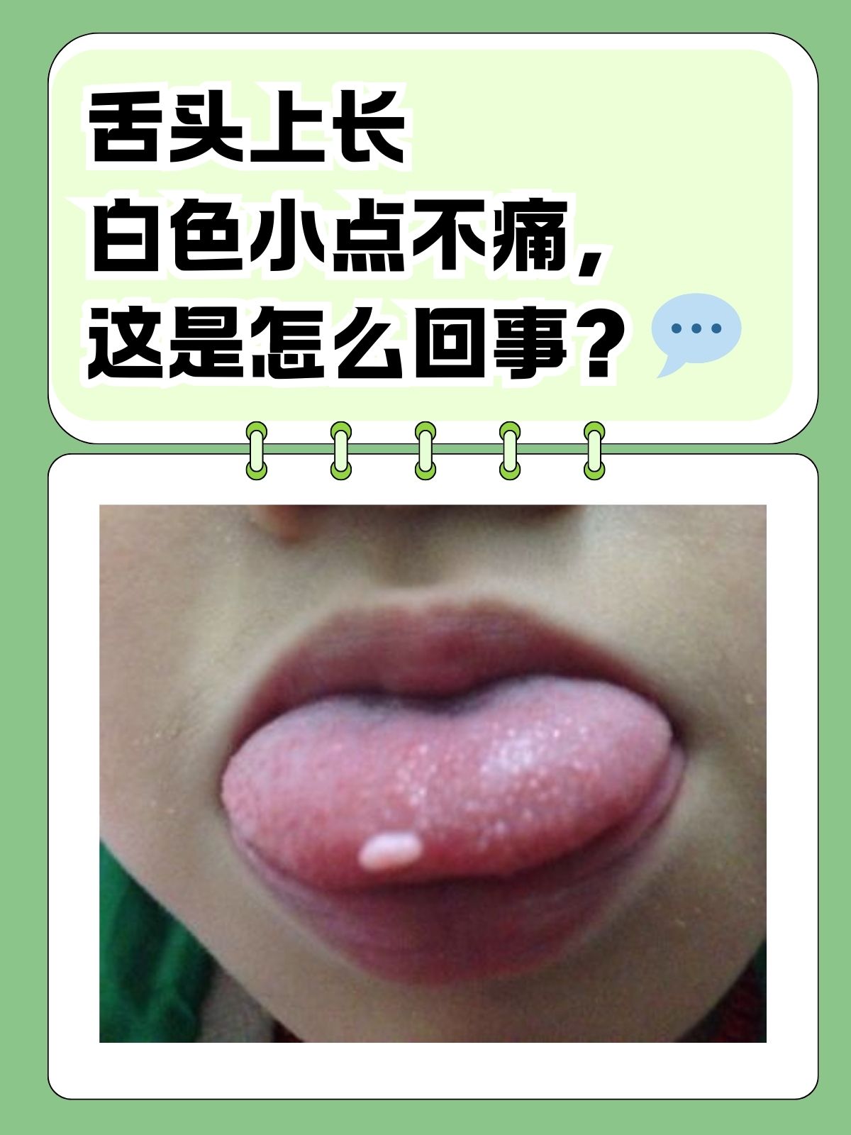 宝宝舌苔发白怎么回事