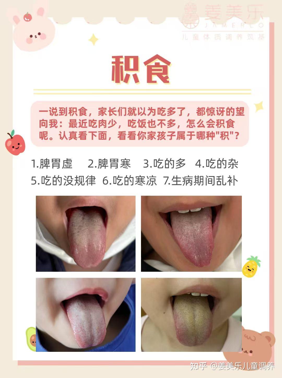 宝宝舌苔发白怎么回事