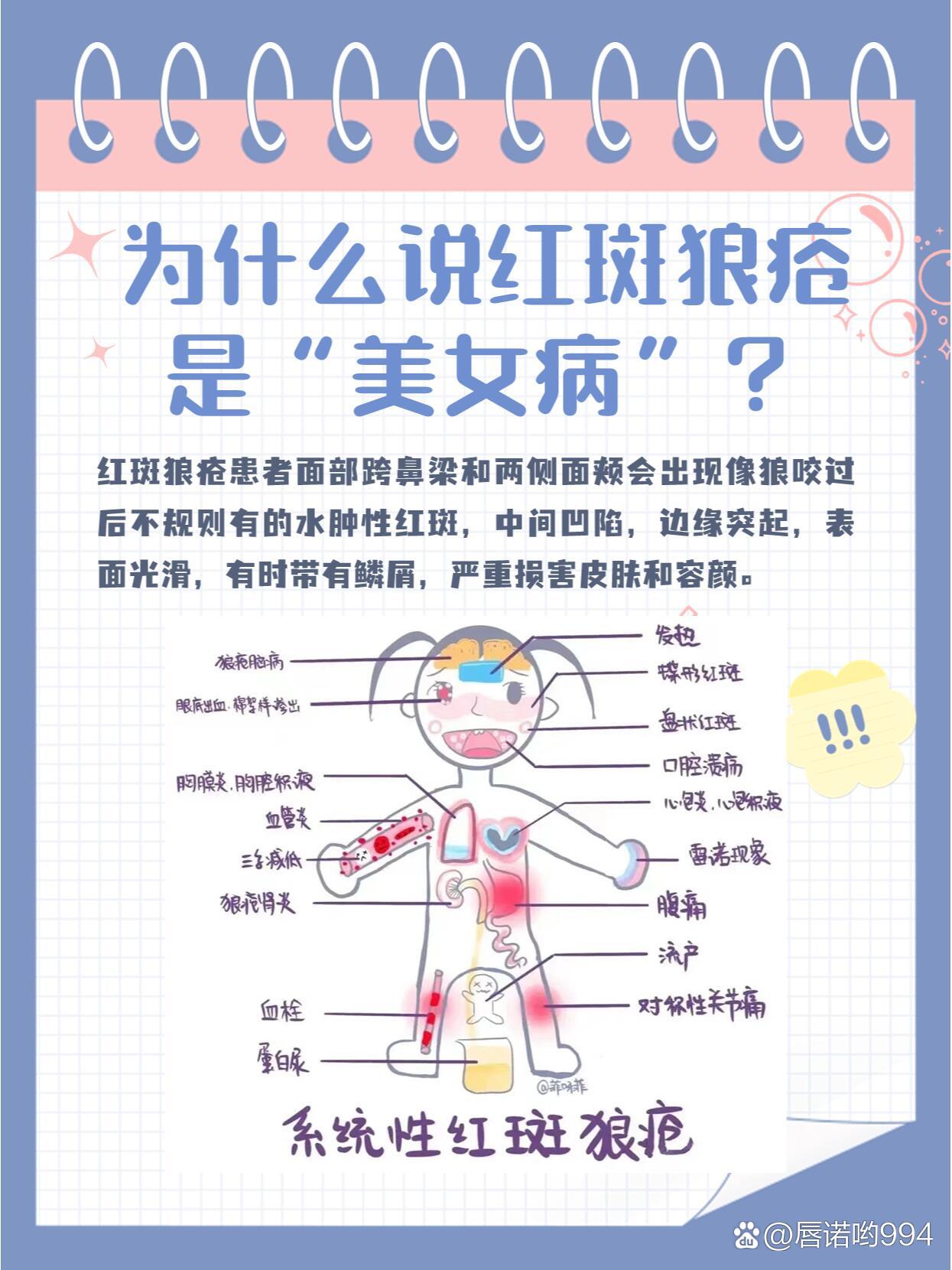 红斑狼疮是什么原因引起的