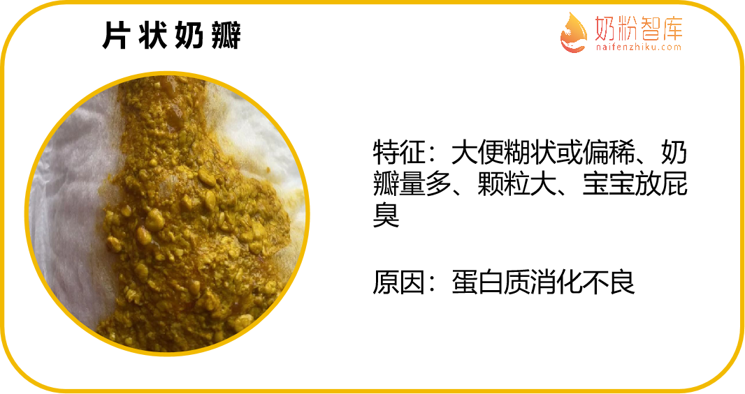 宝宝拉奶瓣屎,需要换奶粉吗?