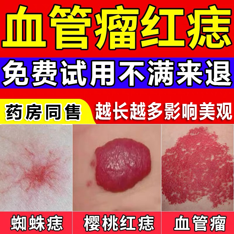 脸上长红色的点点是什么情况?