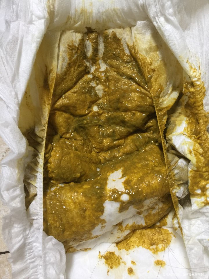 肚子疼腹泻拉的像水一样