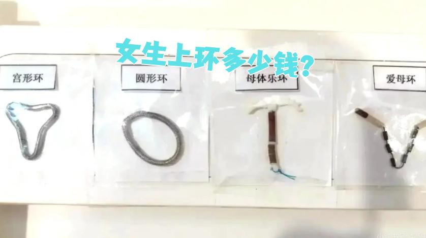 上环大概需要多少钱?