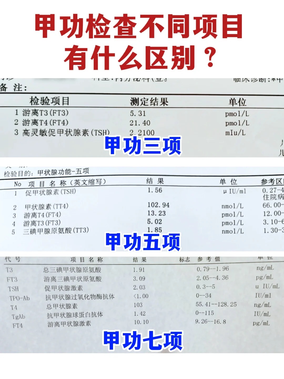 甲功三项正常值是多少