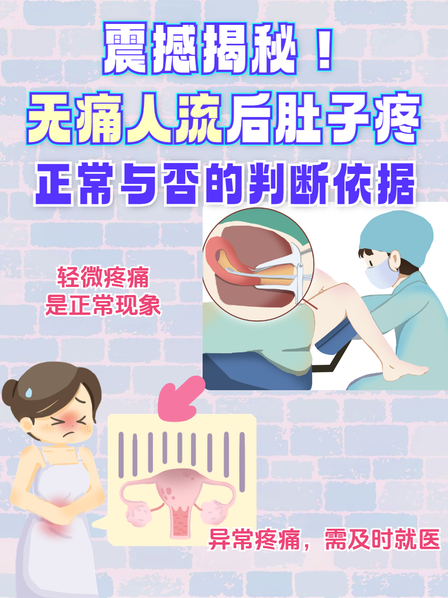 无痛人流手术是什么意思