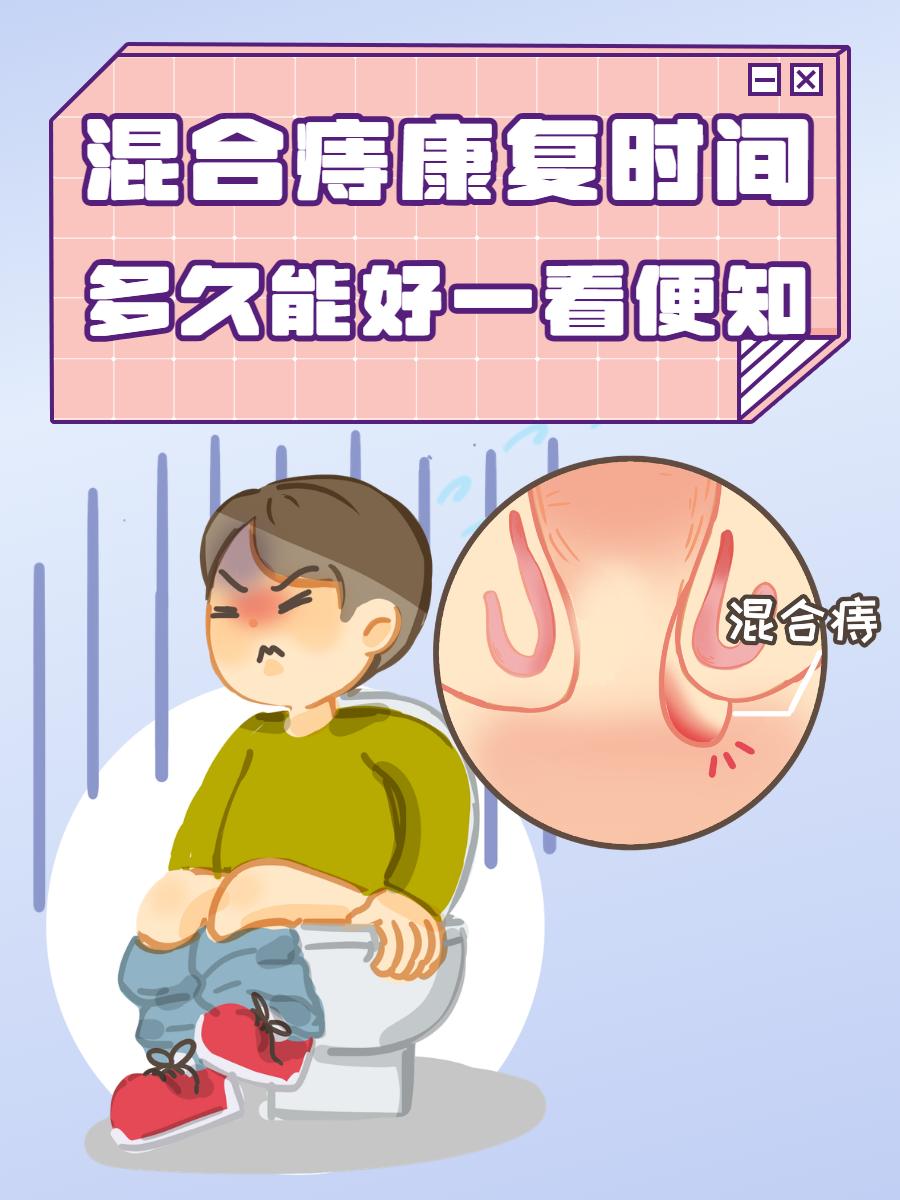 混合痔手术后多久恢复