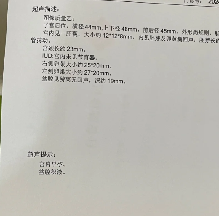 怀孕两个月检查