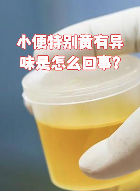小便有异味怎么回事.