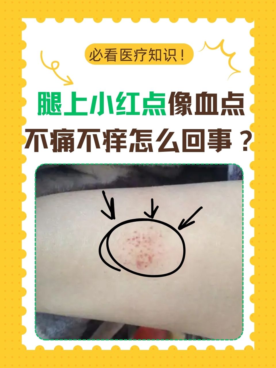 身上有很多小红点是怎么回事