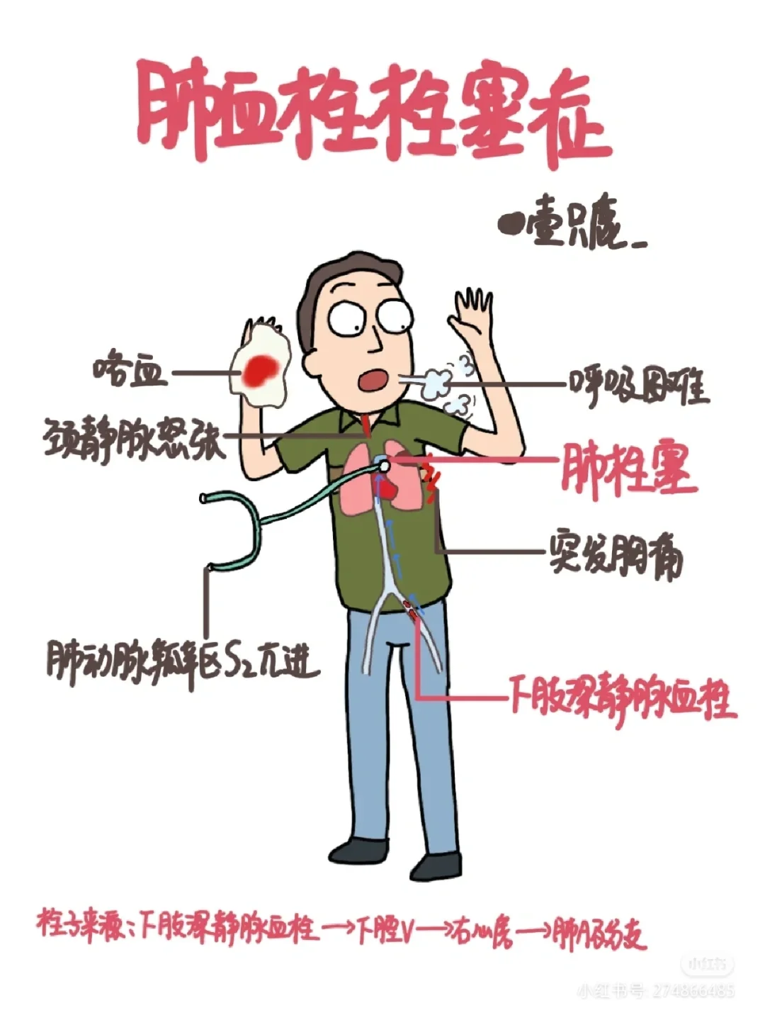 肺栓塞心电图表现有哪些