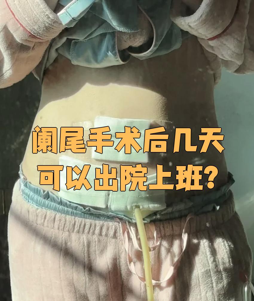 阑尾炎手术几天出院