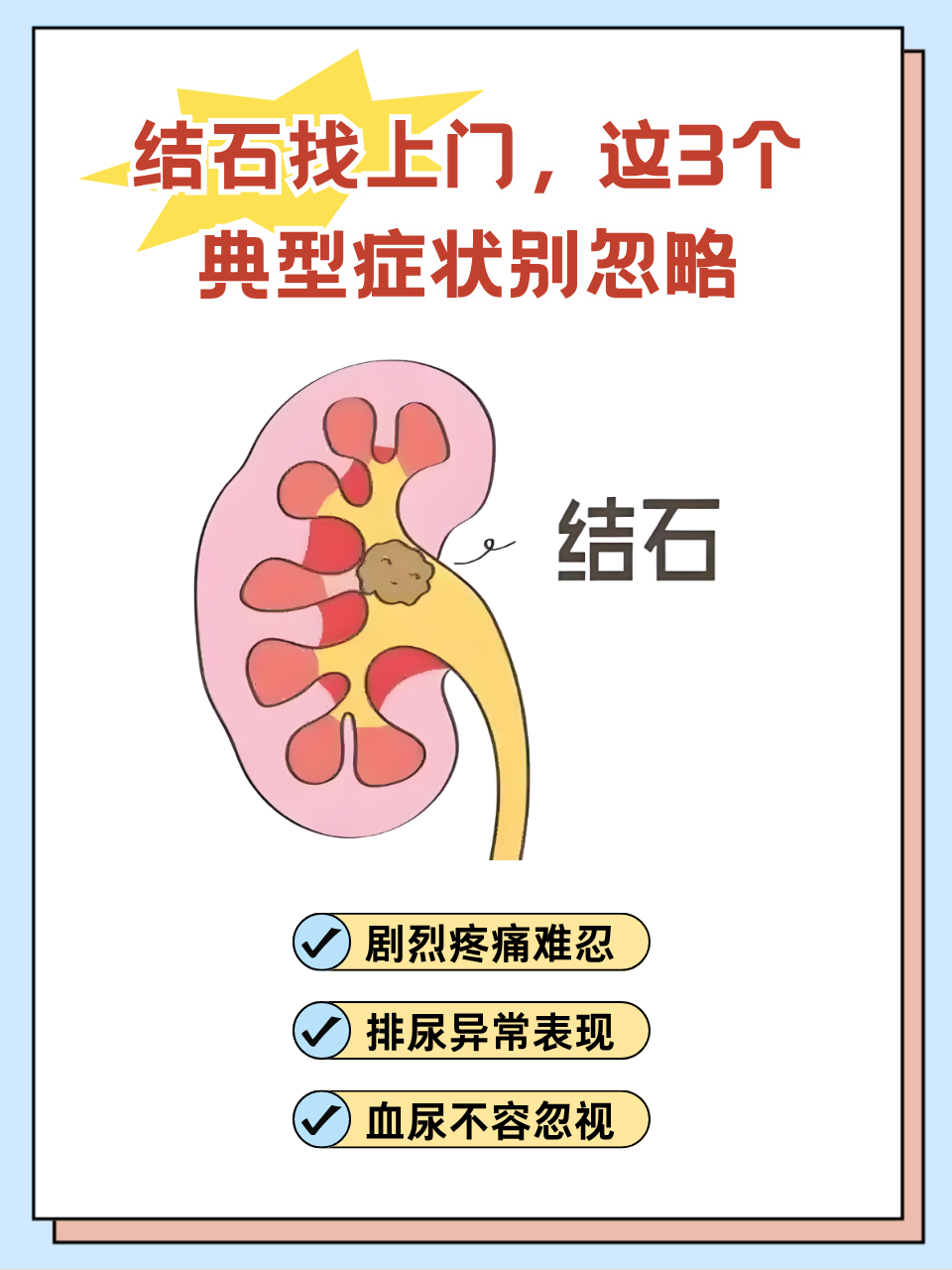 右输尿管结石的症状
