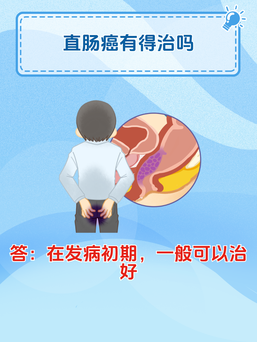 直肠癌早期可以治愈吗?