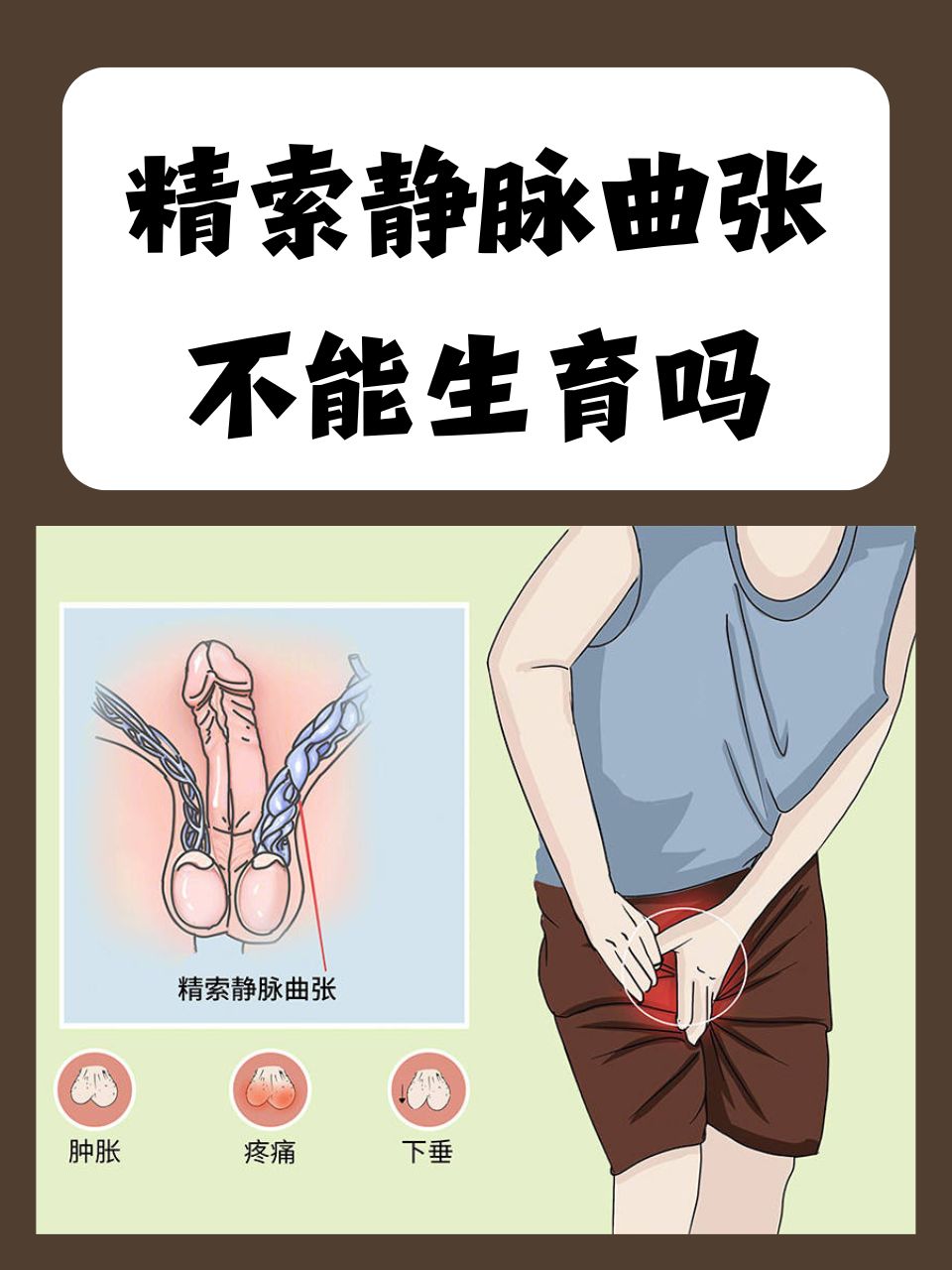 左精索静脉曲张症状有什么呢