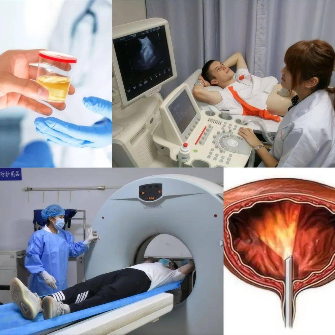 什么情况下需要做膀胱镜