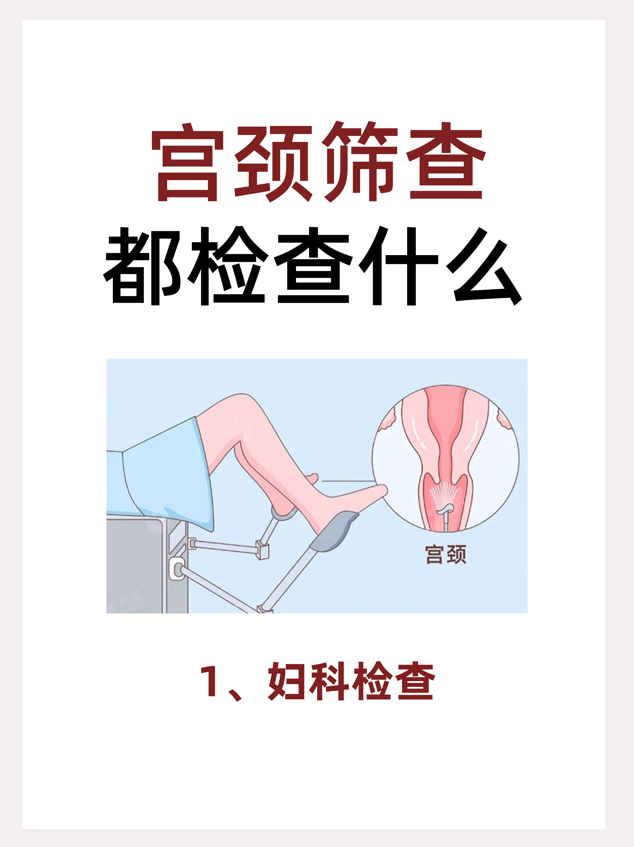 宫颈tct检查是什么意思