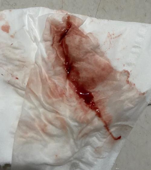 排卵期出血一般几天