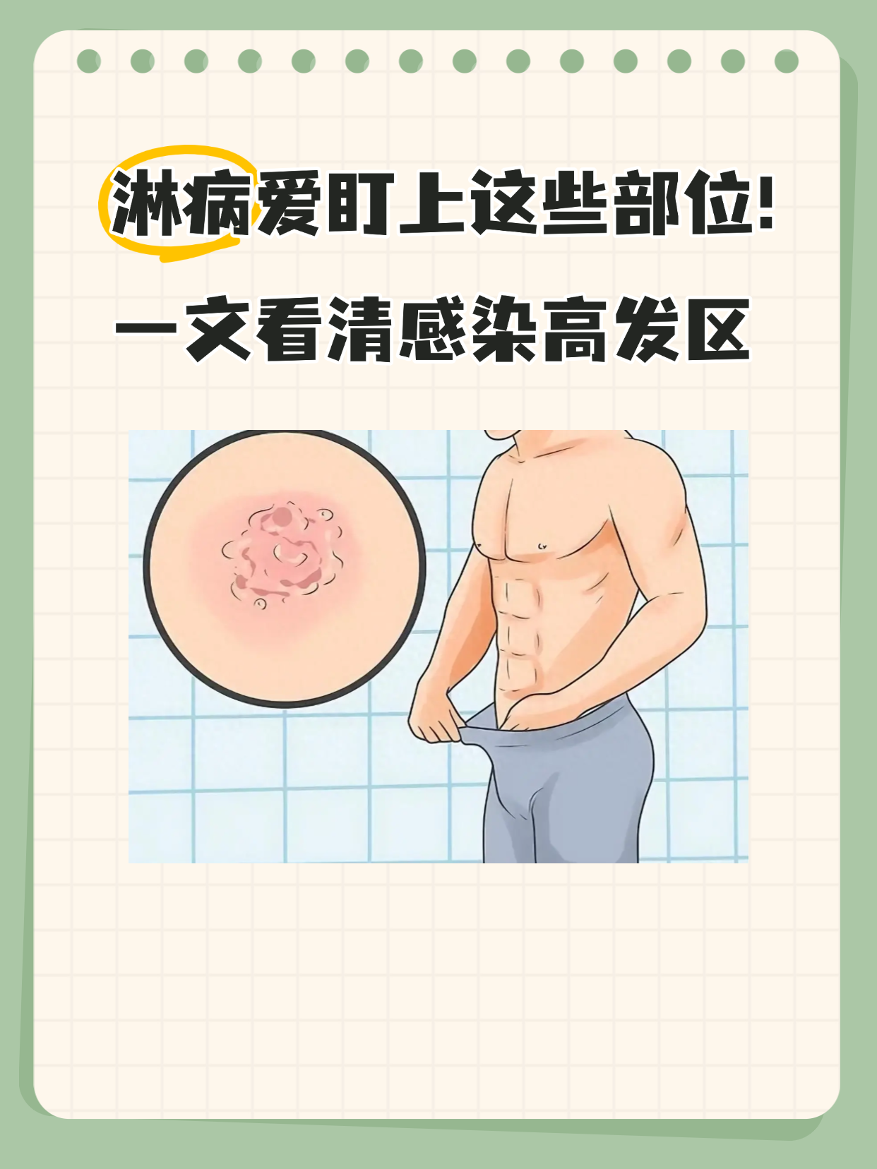 淋病有哪些主要症状