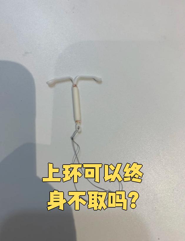 避孕环一辈子不取可以吗?