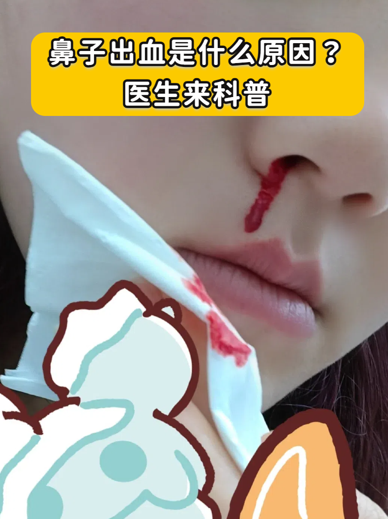 鼻子突然出血怎么回事