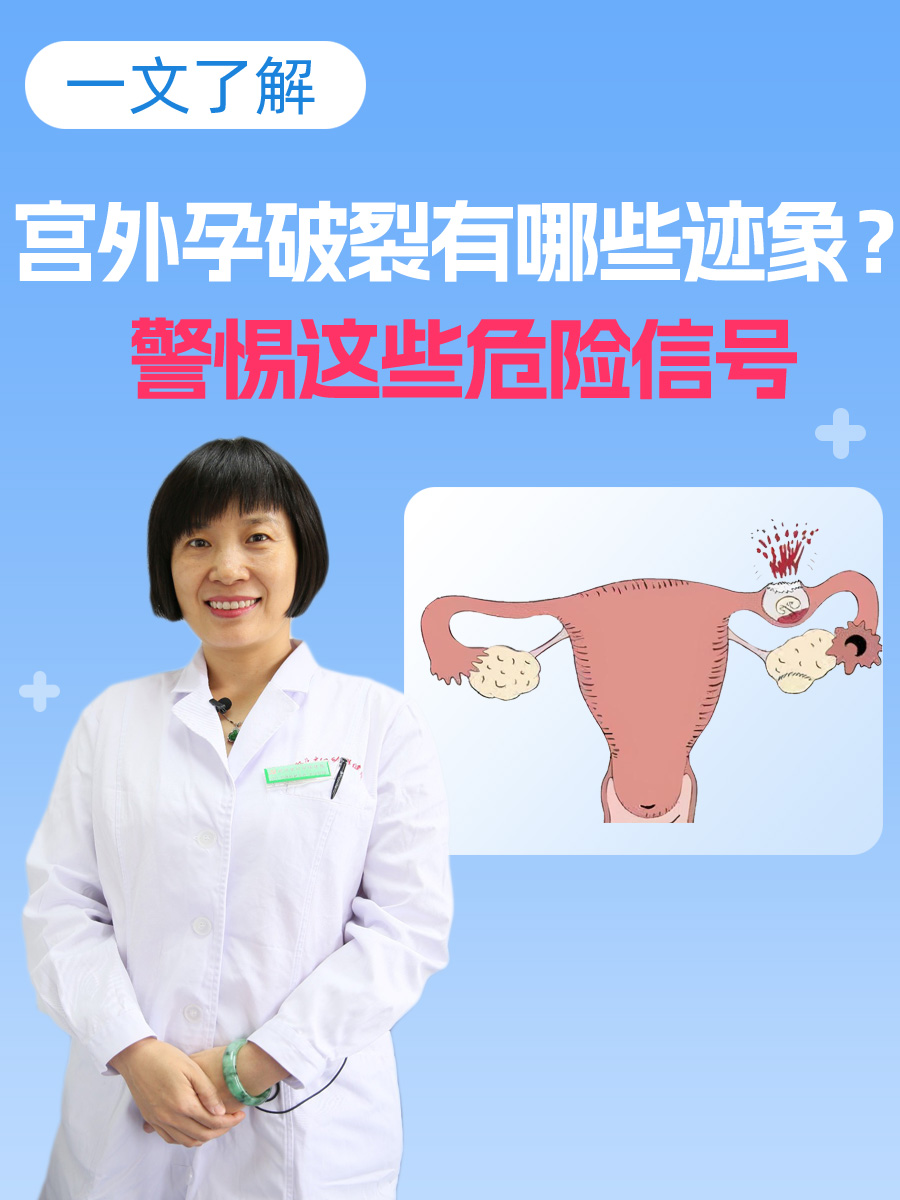 宫外孕的症状表现