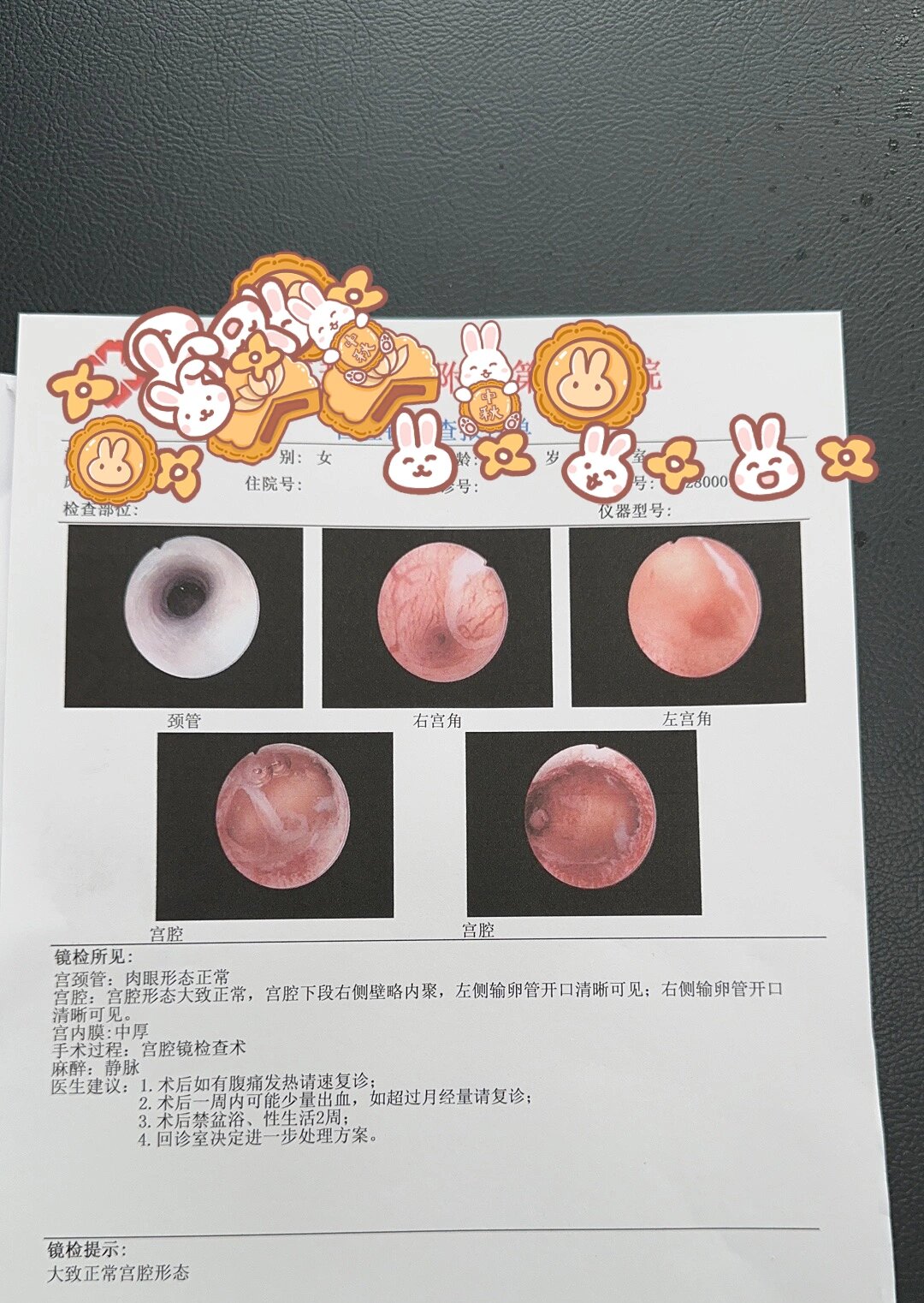 宫腔镜检查疼不疼?