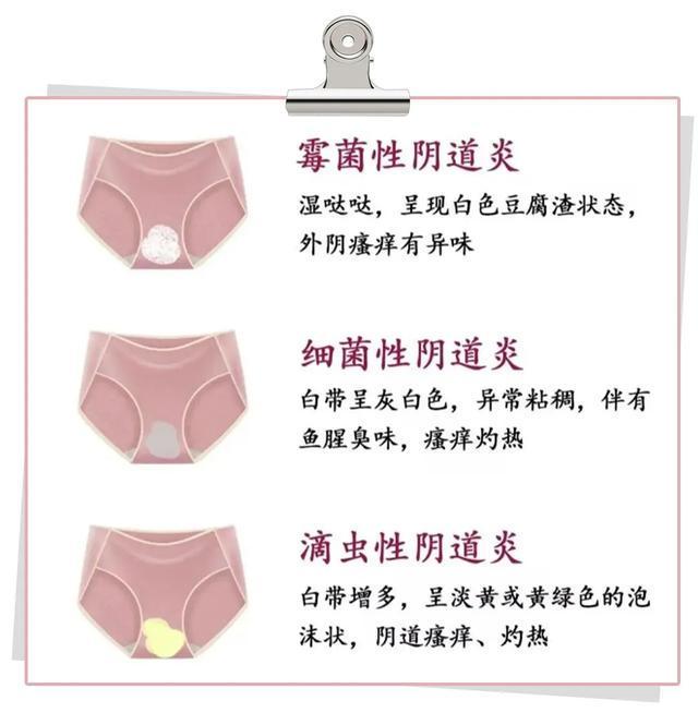 造成外阴瘙痒的原因