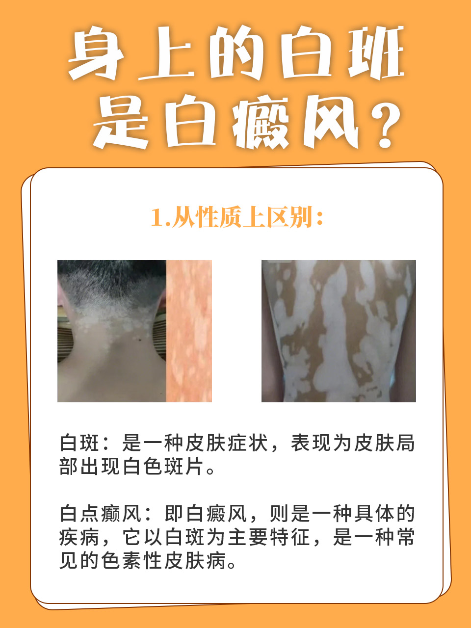 白斑病是怎么得来的