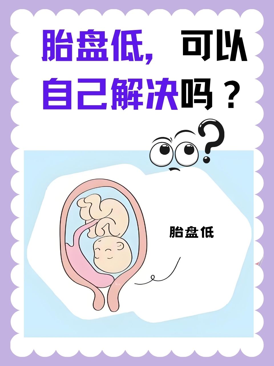 什么是胎盘低置?