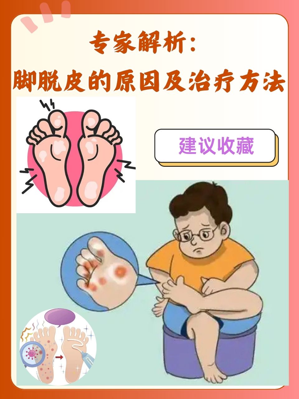 脚缝里痒还脱皮怎么回事?